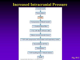 Increased Intracranial Pressure
Fig. 55-3
 