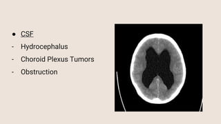 ● CSF
- Hydrocephalus
- Choroid Plexus Tumors
- Obstruction
 