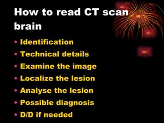 How to read CT scan brain Identification Technical details Examine the image Localize the lesion Analyse the lesion Possible diagnosis D/D if needed 