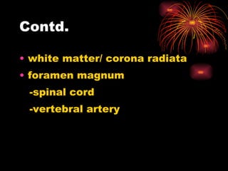 Contd. white matter/ corona radiata foramen magnum  -spinal cord -vertebral artery 