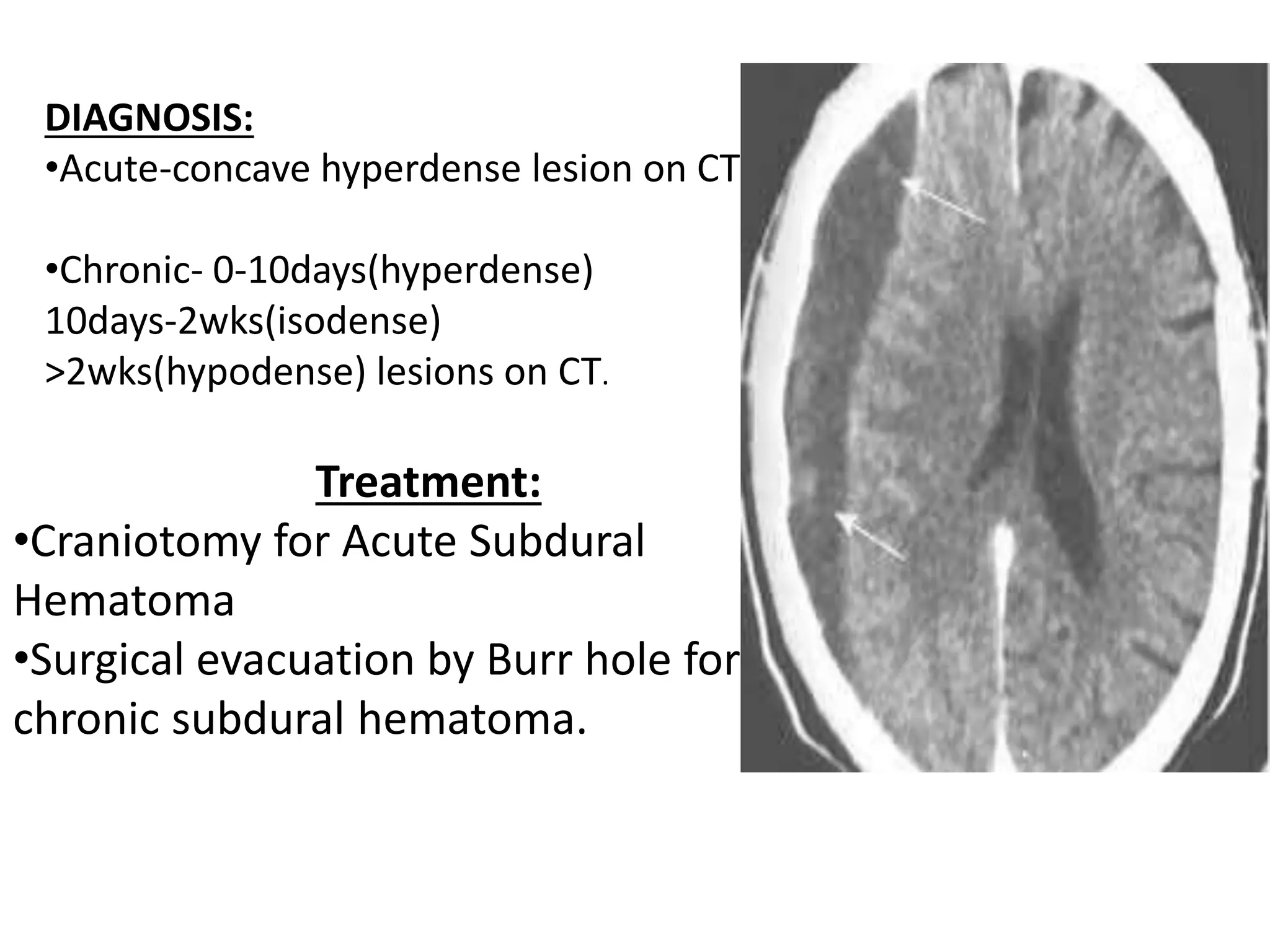 Intracranial space occupying lesions | PPTX
