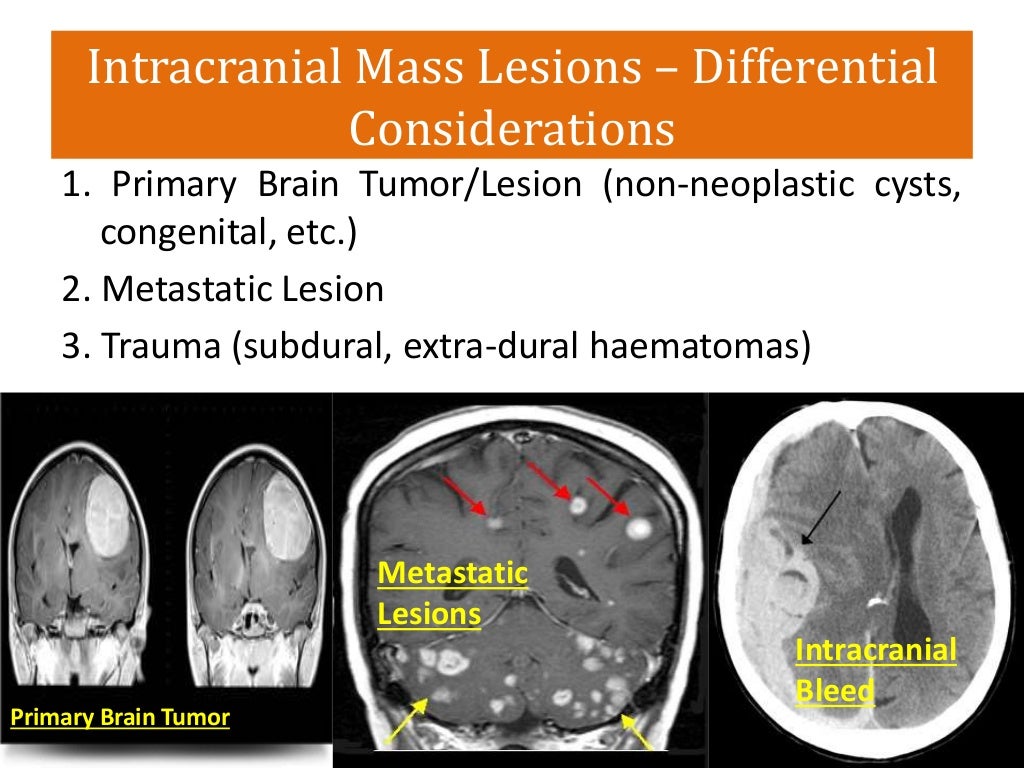 Intracranial space occupying lesions
