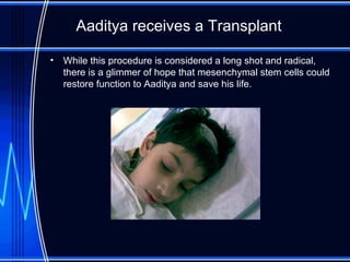 Aaditya receives a Transplant While this procedure is considered a long shot and radical, there is a glimmer of hope that mesenchymal stem cells could restore function to Aaditya and save his life.  