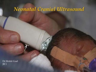 Neonatal Cranial Ultrasound
Dr Mohit Goel
JR 1
 