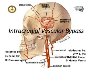 Intracranial Vascular Bypass
Presented By:
Dr. Rahul Jain
SR-2 Neurosurgery
Moderated by:
Dr V. C. Jha
Dr Nitish Kumar
Dr Gaurav Verma
 