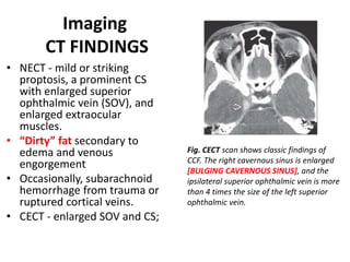 Intracranial vascular malformations | PPTX