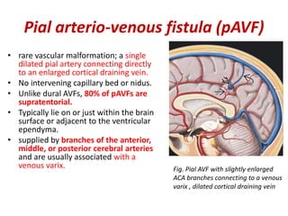 Intracranial vascular malformations | PPTX