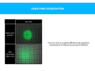 LASER FIBRE DEGREDATION
Η ίνα του laser με τη χρήση φθείρεται έχει χειρότερη
συγκέντρωση της δέσμης και μειωμένη απόδοση
 