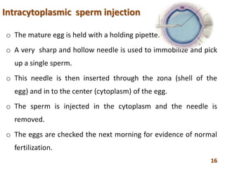 Intracytoplasmic sperm injection
o The mature egg is held with a holding pipette.
o A very sharp and hollow needle is used to immobilize and pick
up a single sperm.
o This needle is then inserted through the zona (shell of the
egg) and in to the center (cytoplasm) of the egg.
o The sperm is injected in the cytoplasm and the needle is
removed.
o The eggs are checked the next morning for evidence of normal
fertilization.
16
 