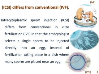 (ICSI) differs from conventional (IVF).
Intracytoplasmic sperm injection (ICSI)
differs from conventional in vitro
fertilization (IVF) in that the embryologist
selects a single sperm to be injected
directly into an egg, instead of
fertilization taking place in a dish where
many sperm are placed near an egg.
6
(IVF)
(ICSI)
 