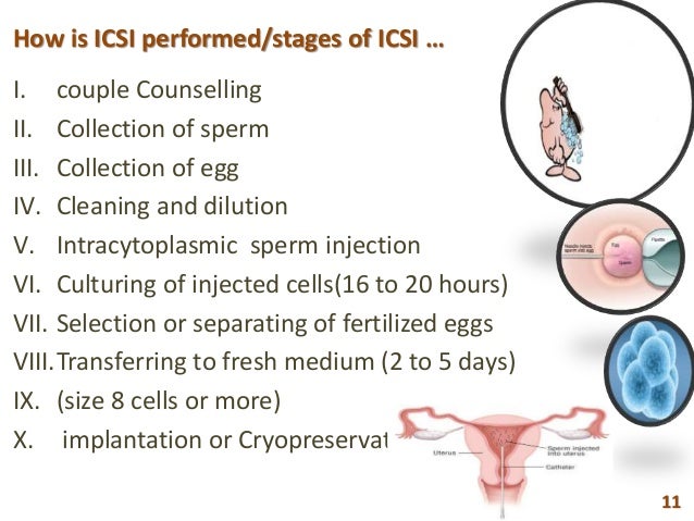 sperm injection home kit