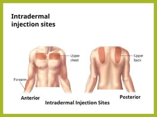 Intradermal-Route-of-Medication-A-Comprehensive-Overview.pptx