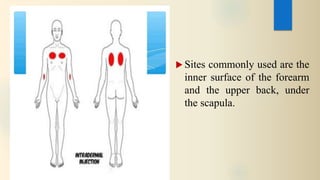 Intradermal injections | PPTX
