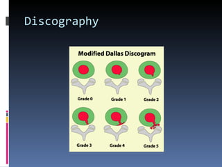 Grading Dallas Discogram Scale Intradiscal procedures | PPT