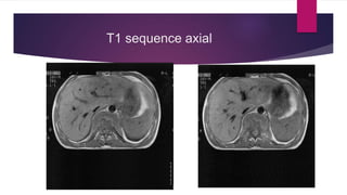 T1 sequence axial
 