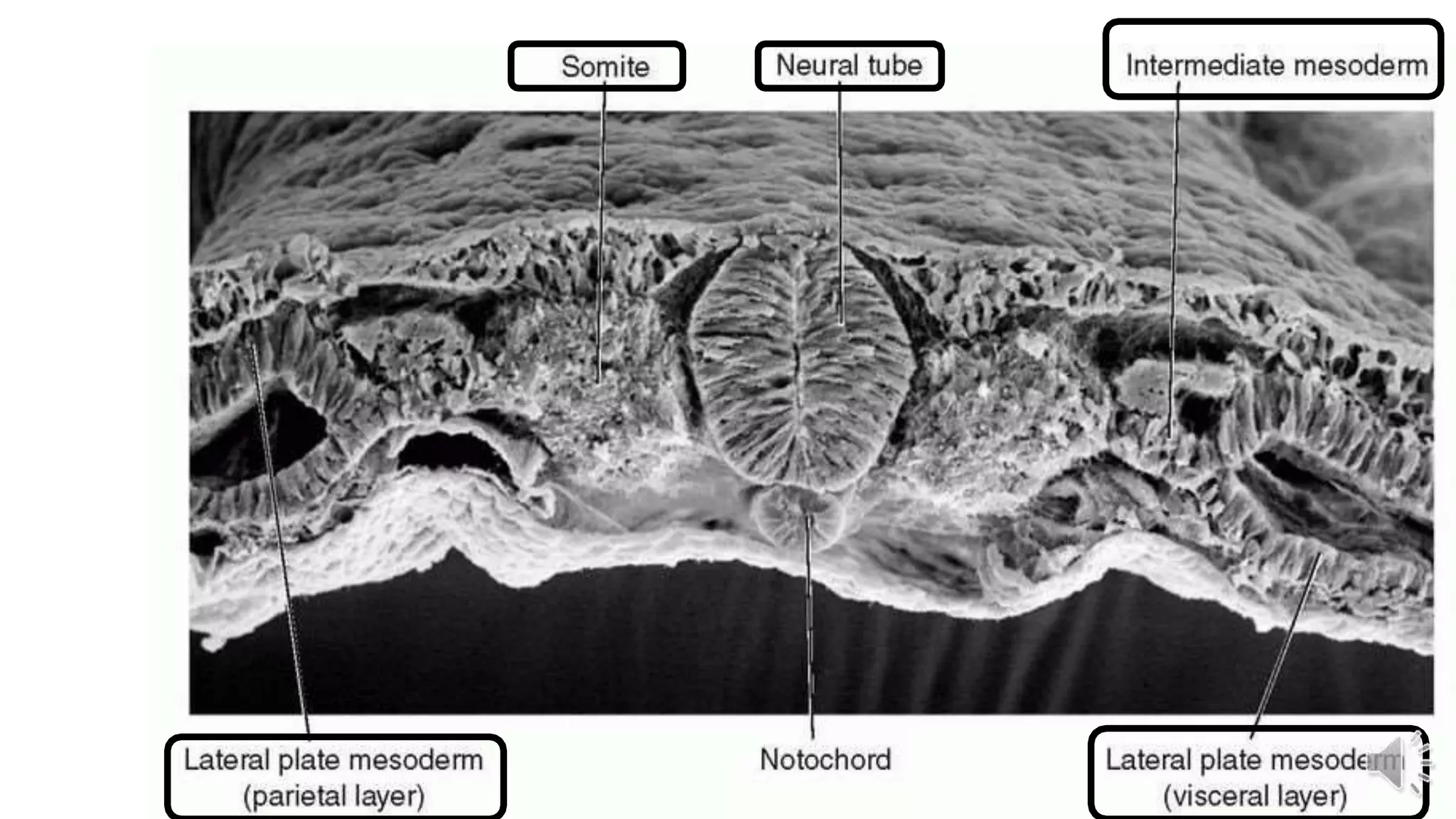Intraembryonic mesoderm | PPTX