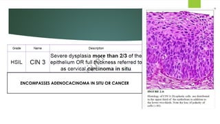 Intraepithelial Neoplasia of cervix in women | PPTX