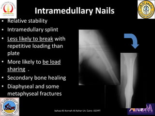 Intramedullary Nails
•
•
•
•
•
•
Relative stability
Intramedullary splint
Less likely to break with
repetitive loading than
plate
More likely to be load
sharing .
Secondary bone healing
Diaphyseal and some
metaphyseal fractures
bahaa Ali Kornah-Al-Azhar Un. Cairo -EGYPT
 