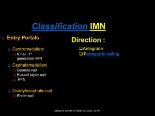 Classification IMN
 Entry Portals :
❑ Centromedullary
❑ K nail ,1st
generation IMN
❑ Cephalomedullary
❑ Gamma nail
❑ Russell taylor nail
❑ PFN
❑ Condylocephalic nail
❑ Ender nail
Direction :
❑Antegrade
❑ Retrograde nailing
bahaa Ali Kornah-Al-Azhar Un. Cairo -EGYPT
 