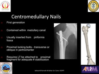 Centromedullary Nails
 First generation
 Contained within medullary canal
 Usually inserted from piriformis
fossa
 Proximal locking bolts - transverse or
oblique in pertrochanter
 Requires LT be attached to proximal
fragment for adequate # stabilization
bahaa Ali Kornah-Al-Azhar Un. Cairo -EGYPT
 