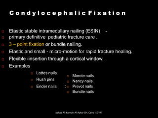 C o n d y l o c e p h a l i c F i x a t i o n
 Morote nails
 Nancy nails
 Prevot nails
 Bundle nails
 Elastic stable intramedullary nailing (ESIN) -
 primary definitive pediatric fracture care .
 3 – point fixation or bundle nailing.
 Elastic and small - micro-motion for rapid fracture healing.
 Flexible -insertion through a cortical window.
 Examples
 Lottes nails
 Rush pins
 Ender nails :
bahaa Ali Kornah-Al-Azhar Un. Cairo -EGYPT
 