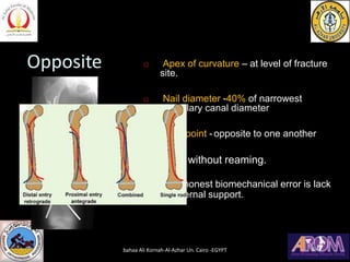 Opposite  Apex of curvature – at level of fracture
site.
 Nail diameter -40% of narrowest
medullary canal diameter
 Entry point -opposite to one another
 Used without reaming.
 Commonest biomechanical error is lack
of internal support.
bahaa Ali Kornah-Al-Azhar Un. Cairo -EGYPT
 