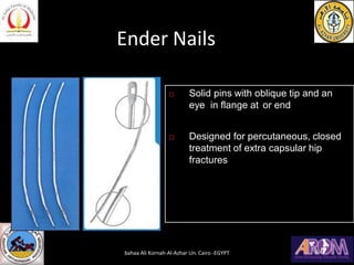 Ender Nails
 Solid pins with oblique tip and an
eye in flange at or end
 Designed for percutaneous, closed
treatment of extra capsular hip
fractures
bahaa Ali Kornah-Al-Azhar Un. Cairo -EGYPT
 