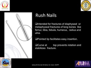 Rush Nails
❑Intended for fractures of diaphyseal or
metaphyseal fractures of long bones like
femur, tibia, febula, humerus, radius and
ulna.
❑Pointed tip facilitates easy insertion.
❑Curve at top prevents rotation and
stabilizes fracture.
bahaa Ali Kornah-Al-Azhar Un. Cairo -EGYPT
 