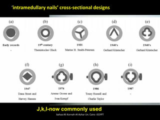 A-schneider
B-diamond
C-sampson fluted
D-kuntscher
E-rush
F-ender
G-mondy
H-halloran
i-huckstep
J-AO/ASIF
K-grosse –kempf
L-russell-taylor
J,k,l-now commonly used
‘intramedullary nails’ cross-sectional designs
bahaa Ali Kornah-Al-Azhar Un. Cairo -EGYPT
 