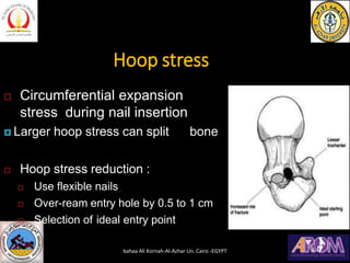 Hoop stress
 Circumferential expansion
stress during nail insertion
 Larger hoop stress can split bone
 Hoop stress reduction :
 Use flexible nails
 Over-ream entry hole by 0.5 to 1 cm
 Selection of ideal entry point
bahaa Ali Kornah-Al-Azhar Un. Cairo -EGYPT
 