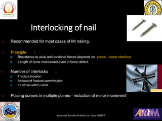 Interlocking of nail
 Recommended for most cases of IM nailing.
 Principle :
 Resistance to axial and torsional forces depends on screw – bone interface
 Length of bone maintained even in bone defect.
 Number of interlocks :
 Fracture location
 Amount of fracture comminution
 Fit of nail within canal.
 Placing screws in multiple planes - reduction of minor movement
bahaa Ali Kornah-Al-Azhar Un. Cairo -EGYPT
 