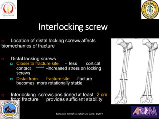 Interlocking screw
 Location of distal locking screws affects
biomechanics of fracture
 Distal locking screws
 Closer to fracture site - less cortical
contact -increased stress on locking
screws
 Distal from fracture site -fracture
becomes more rotationally stable
 Interlocking screws positioned at least 2 cm
from fracture provides sufficient stability
bahaa Ali Kornah-Al-Azhar Un. Cairo -EGYPT
 