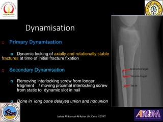Dynamisation
 Primary Dynamisation
 Dynamic locking of axially and rotationally stable
fractures at time of initial fracture fixation
 Secondary Dynamisation
 Removing interlocking screw from longer
fragment / moving proximal interlocking screw
from static to dynamic slot in nail
 Done in long bone delayed union and nonunion
bahaa Ali Kornah-Al-Azhar Un. Cairo -EGYPT
 