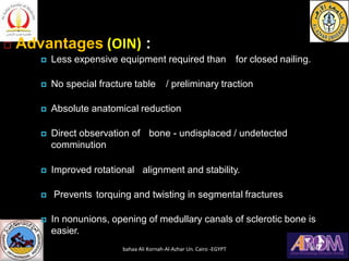  Advantages (OIN) :
 Less expensive equipment required than for closed nailing.
 No special fracture table / preliminary traction
 Absolute anatomical reduction
 Direct observation of bone - undisplaced / undetected
comminution
 Improved rotational alignment and stability.
 Prevents torquing and twisting in segmental fractures
 In nonunions, opening of medullary canals of sclerotic bone is
easier.
bahaa Ali Kornah-Al-Azhar Un. Cairo -EGYPT
 