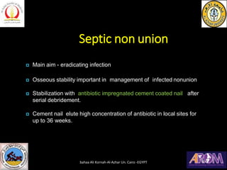 Septic non union
 Main aim - eradicating infection
 Osseous stability important in management of infected nonunion
 Stabilization with antibiotic impregnated cement coated nail after
serial debridement.
 Cement nail elute high concentration of antibiotic in local sites for
up to 36 weeks.
bahaa Ali Kornah-Al-Azhar Un. Cairo -EGYPT
 