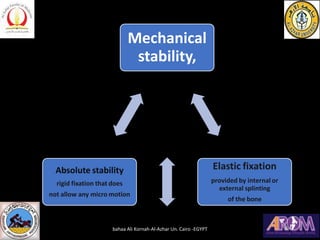 Mechanical
stability,
Elastic fixation
provided by internal or
external splinting
of the bone
Absolute stability
rigid fixation that does
not allow any micro motion
bahaa Ali Kornah-Al-Azhar Un. Cairo -EGYPT
 