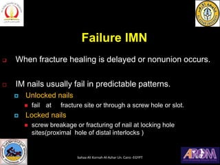 Failure IMN
❑ When fracture healing is delayed or nonunion occurs.
 IM nails usually fail in predictable patterns.
 Unlocked nails
◼ fail at fracture site or through a screw hole or slot.
 Locked nails
◼ screw breakage or fracturing of nail at locking hole
sites(proximal hole of distal interlocks )
bahaa Ali Kornah-Al-Azhar Un. Cairo -EGYPT
 