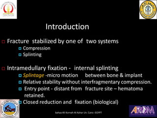Introduction
 Fracture stabilized by one of two systems
 Compression
 Splinting
 Intramedullary fixation - internal sp...