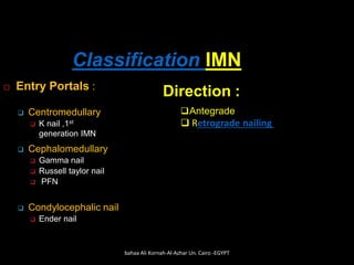Classification IMN
 Entry Portals :
❑ Centromedullary
❑ K nail ,1st
generation IMN
❑ Cephalomedullary
❑ Gamma nail
❑ Russ...