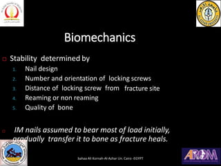 Biomechanics
 Stability determined by
fracture site
1. Nail design
2. Number and orientation of locking screws
3. Distanc...