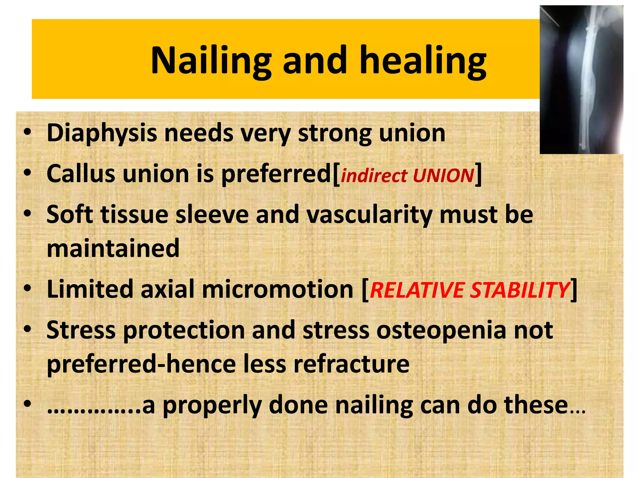 Intramedullary nailing of fractures.dr mohamed ashraf.HOD.govt TD ...