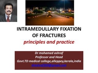 INTRAMEDULLARY FIXATION
OF FRACTURES
principles and practice
Dr mohamed ashraf
Professor and Head
Govt.TD medical college,alleppey,kerala,india
drashraf369@gmail.com
 