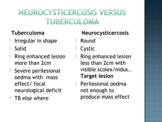 Intramedullary neurocysticercosis Slide 19