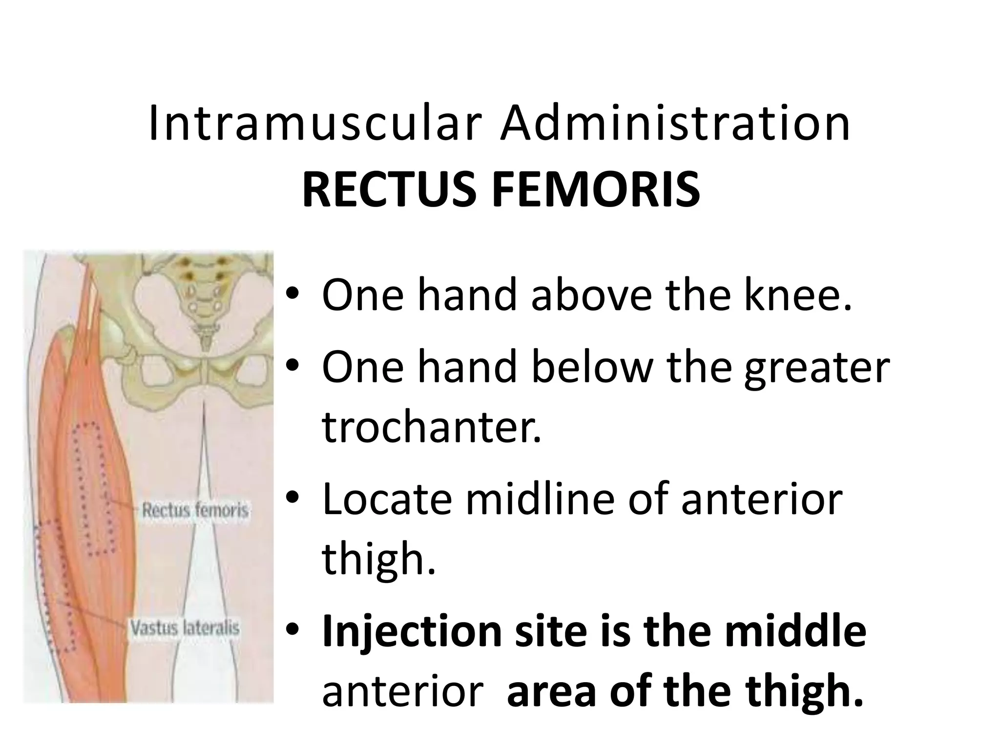 Intramuscular Administration
RECTUS FEMORIS
• One hand above the knee.
• One hand below the greater
trochanter.
• Locate midline of anterior
thigh.
• Injection site is the middle
anterior area of the thigh.
 