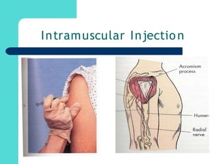 Intramuscular Injection
 