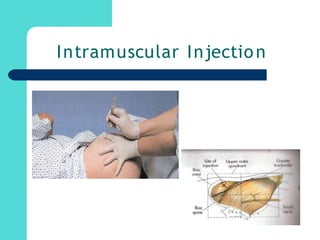 Intramuscular Injection
 
