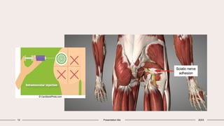 12 Presentation title 20XX
 