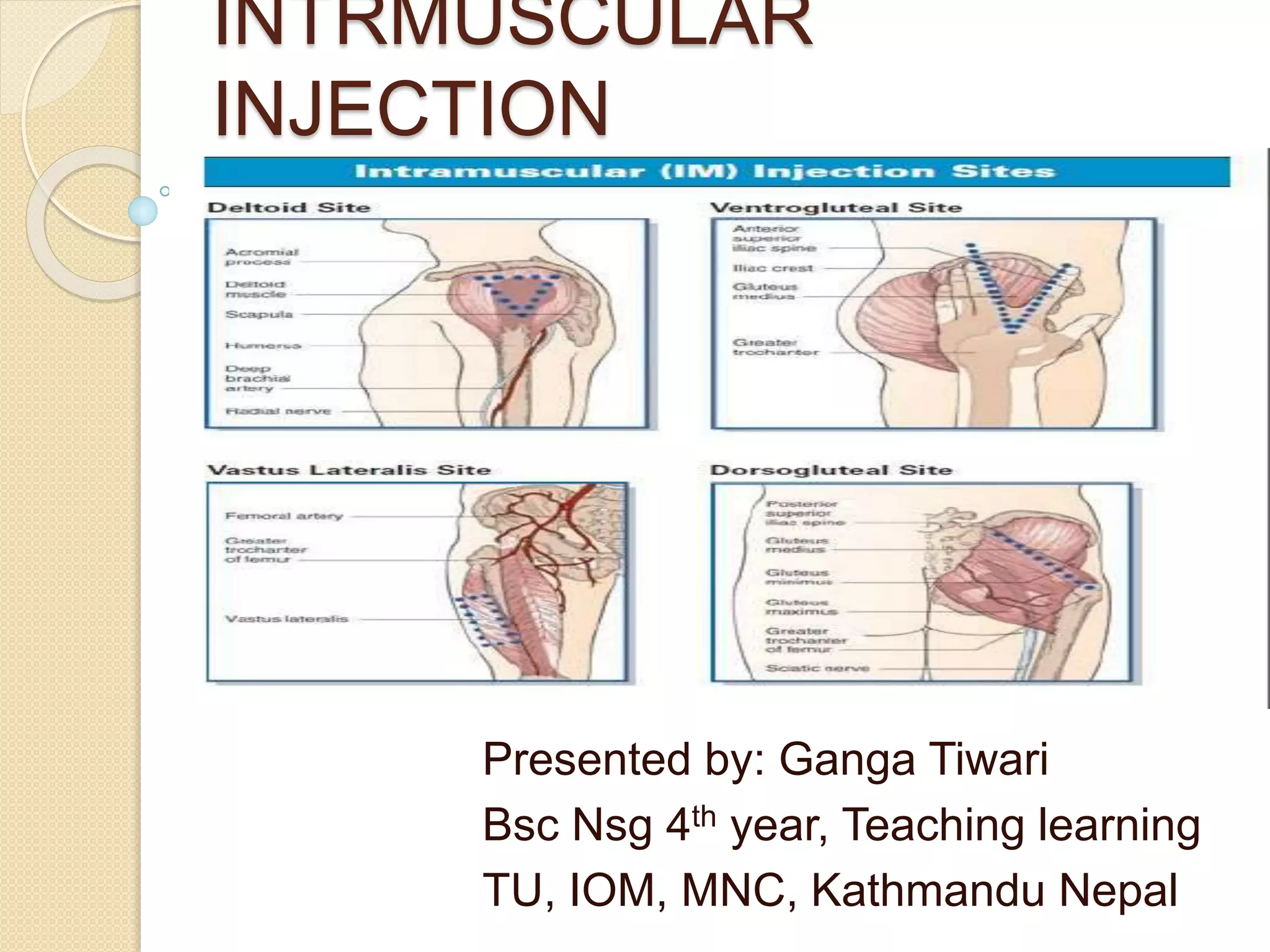 Intramuscular Injection Diagram Intramuscular Injection Diagram