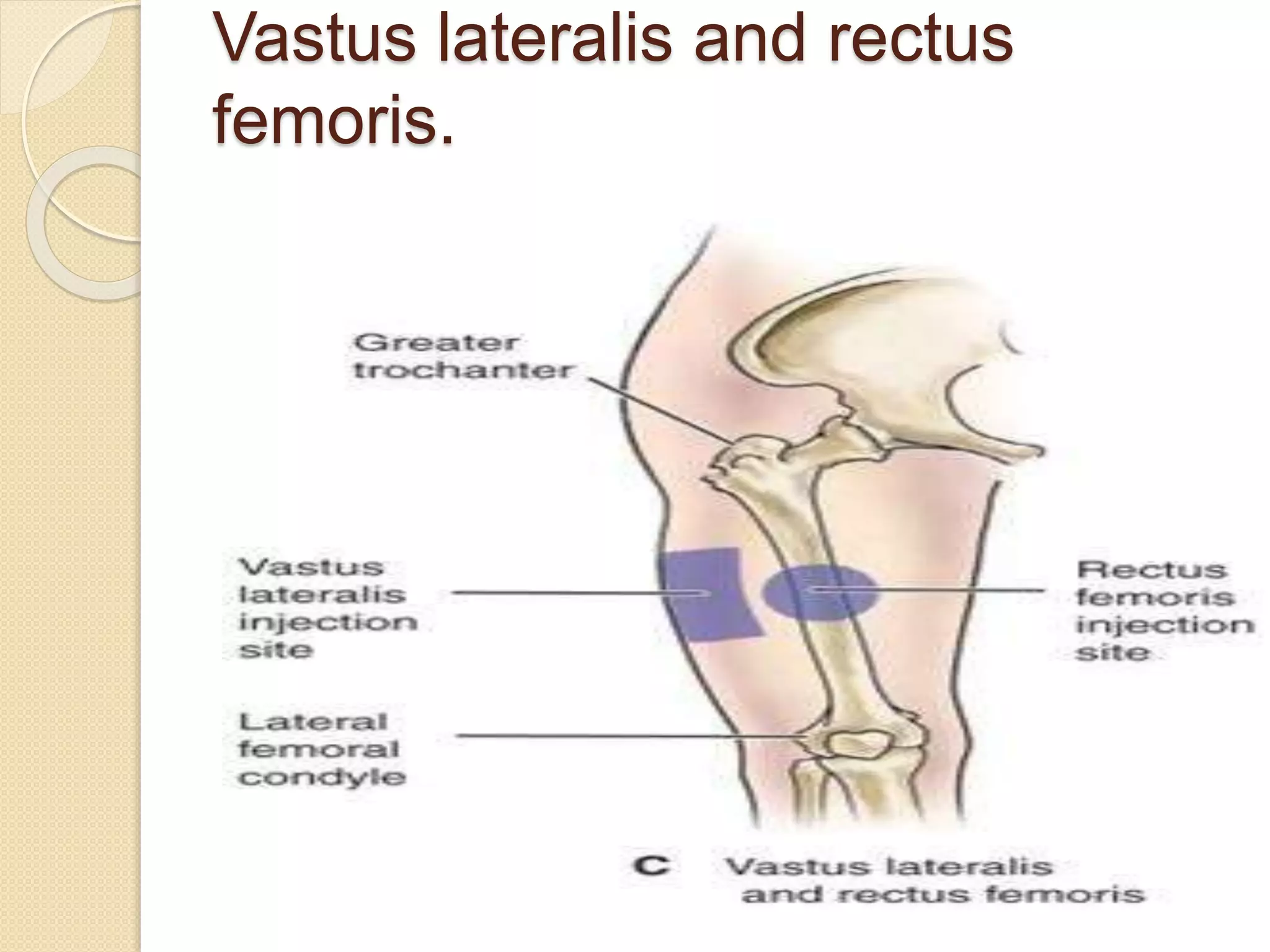 Intramuscular Injection -common sites, procedure, complications | PPTX