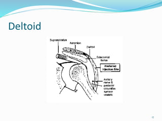 Deltoid
17
 